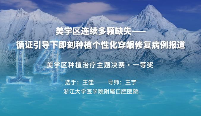 美学区连续多颗缺失——循证引导下即刻种植个性化穿龈修复病例报道