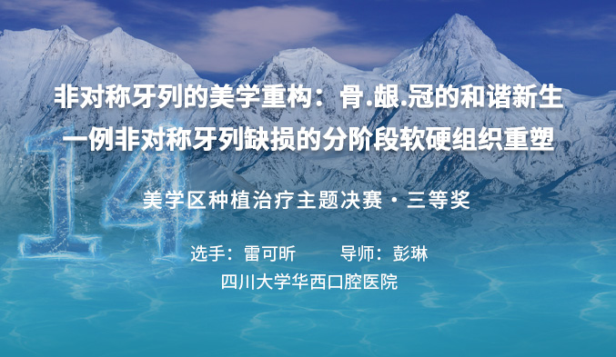 非对称牙列的美学重构：骨.龈.冠的和谐新生 —— 一例非对称牙列缺损的分阶段软硬组织重塑
