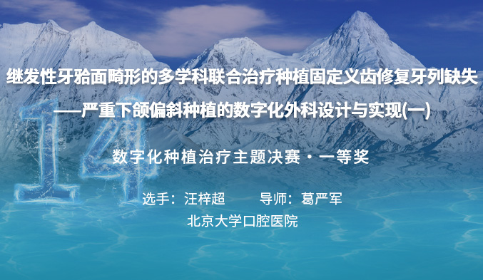 继发性牙𬌗面畸形的多学科联合治疗种植固定义齿修复牙列缺失 ——严重下颌偏斜种植的数字化外科设计与实现（一）